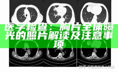 医学检查：胸片全体曝光的照片解读及注意事项
