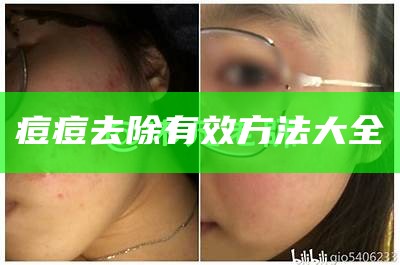 痘痘去除有效方法大全